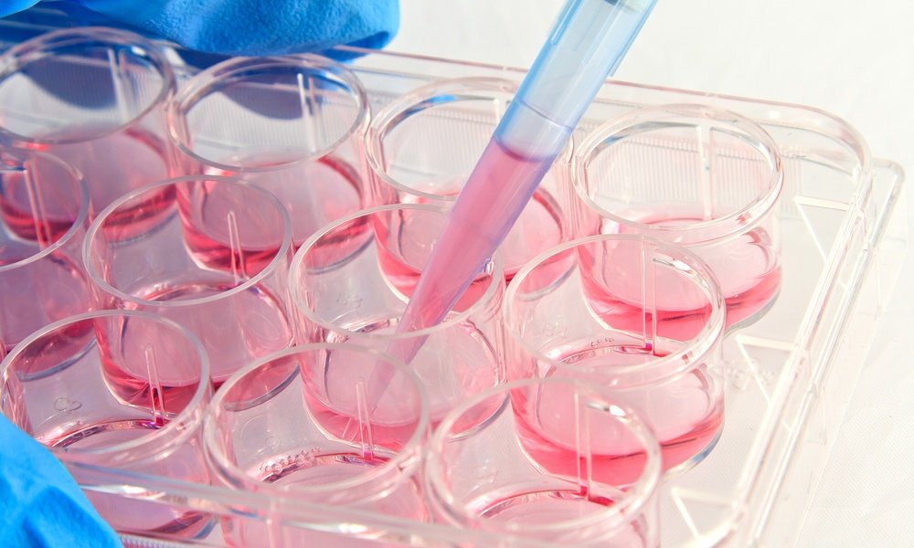 How to Obtain a Primary Culture of Cancer Cells